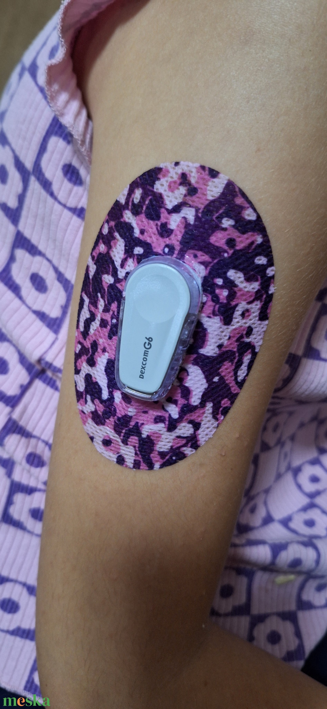 Dexcom G6 vércukormérő szenzorhoz mintás tapasz (szenzortapasz) 5 db/ csomag - otthon & életmód - papír, írószer - matrica, matrica csomag - Meska.hu Dexcom G6 vércukormérő szenzorhoz mintás tapasz (szenzortapasz) 5 db/ csomag - otthon & életmód - papír, írószer - matrica, matrica csomag - Meska.hu