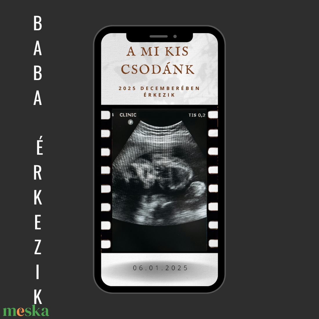 Instagram Terhességi Bejelentő, Baba Bejelentés, Ultrahang, Közösségi Média, Polaroid Stílus - művészet - grafika & illusztráció - digitális - Meska.hu Instagram Terhességi Bejelentő, Baba Bejelentés, Ultrahang, Közösségi Média, Polaroid Stílus - művészet - grafika & illusztráció - digitális - Meska.hu