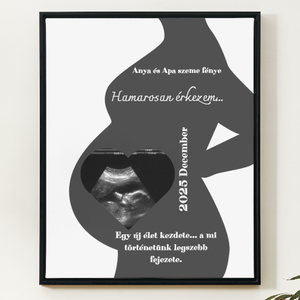 Baba bejelentő egyedi fénykép ajándék - Meska.hu