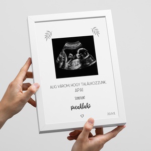 Bababejelentő Apának, Mamának ultrahangos képpel A/4-es méretben (digitálisan vagy fotópapírra nyomtatva, keretezve) - Meska.hu